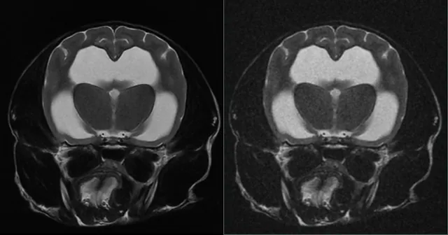 MRI 검사, AI가 도와드립니다 — MRI·CT 영상