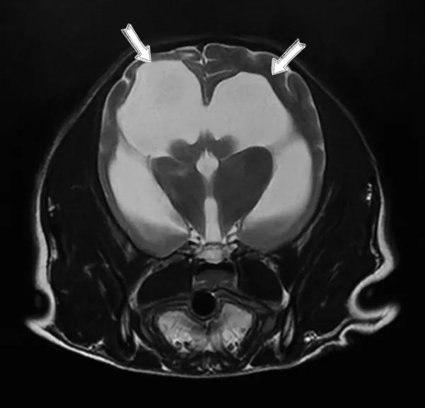 강아지 머리에 물이 차 있다고요? — 뇌수두증 — MRI·CT 영상