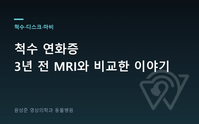척수 연화증 — 3년 전 MRI와 비교한 이야기