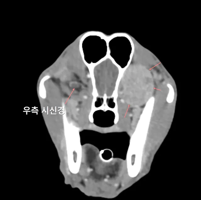 시력이 사라진 환자에서 CT와 MRI 검사 — MRI·CT 영상
